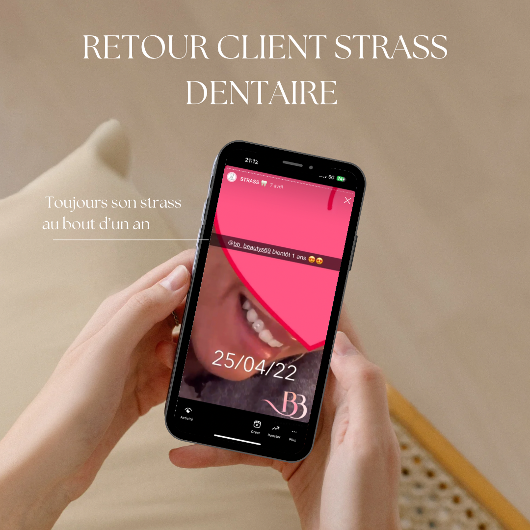 Colle strass  dentaire